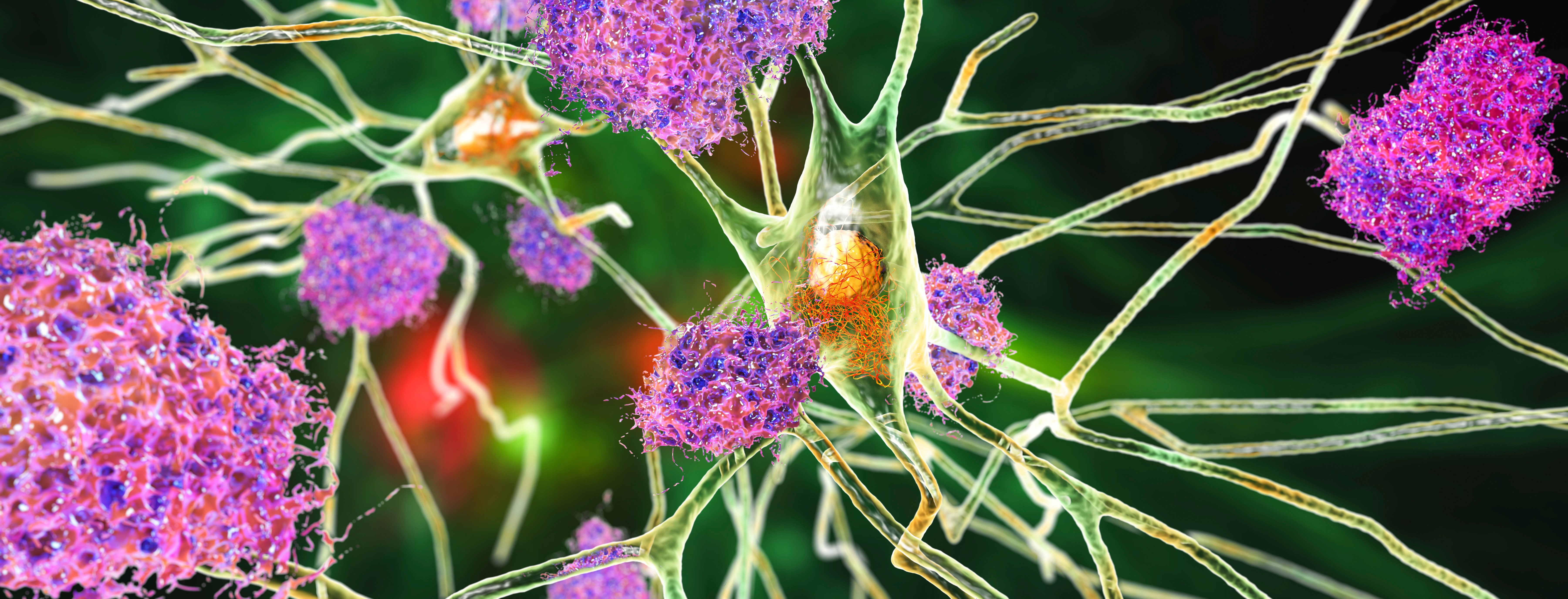 Choline tegen alzheimer