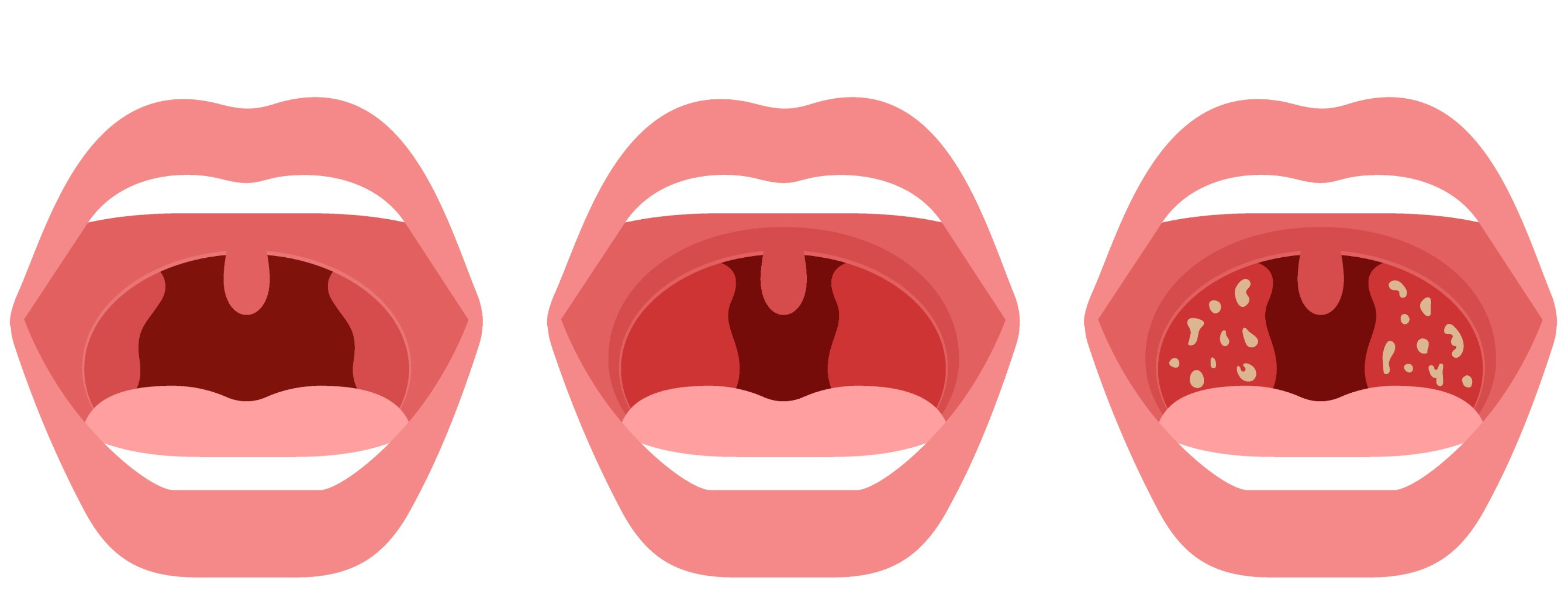 Verzorg je amandelen met natuurlijke middelen