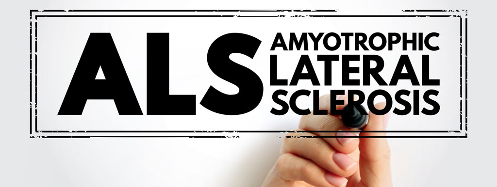 Carnitine als antioxidant bij ALS