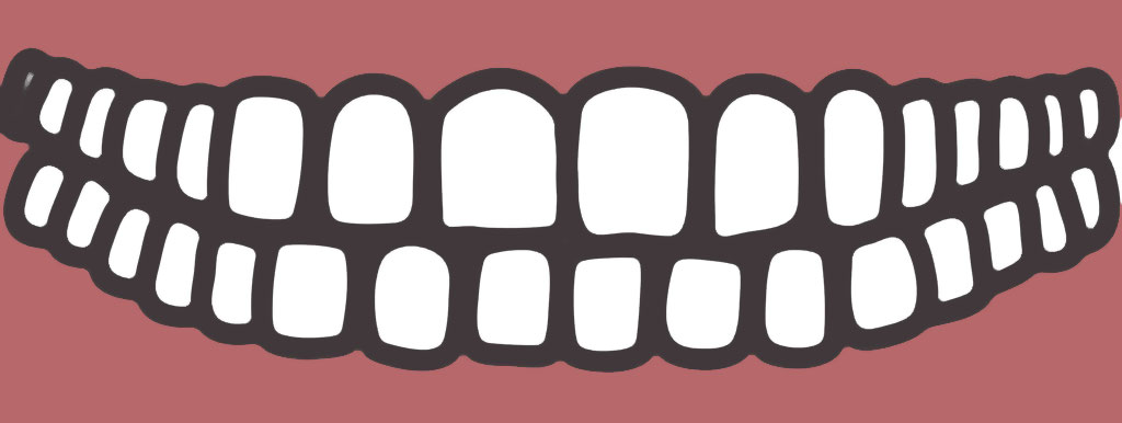 Arginine versus cariës