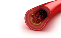 Cholesterol is niet ongezond