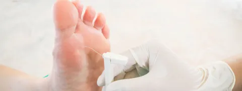 Associatie tussen ijzerinname en diabetische neuropathie