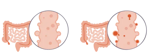 Mucuslaag van de darmen