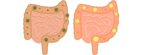 Minder antibiotica-geassocieerde diarree bij verpleeghuisbewoners met probiotica