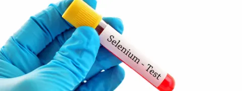 Seleniumstatus vs leverziekte