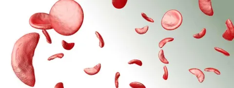 Selenium bij sikkelcelziekte