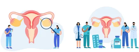 Hyaluron, chondroïtine en glucosamine voor de urinewegen