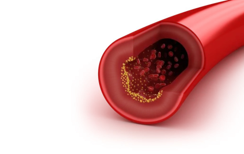 B-vitaminen en homocysteïne