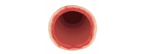 Vitamine C beschermt endotheel