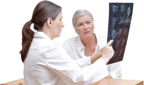 Vrouwen lopen meer kans op hersenbloeding bij te laag LDL-cholesterol