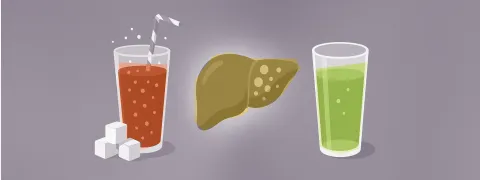 Frisdrank niet goed voor de lever