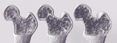 Calcium, meer dan alleen botgezondheid