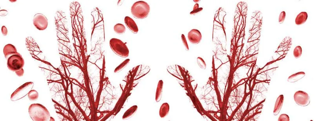 Koolhydraatbeperking maakt bloedvaten enkel bij vrouwen soepeler