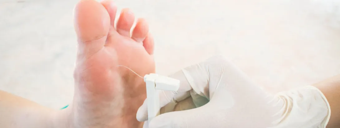 Associatie tussen ijzerinname en diabetische neuropathie