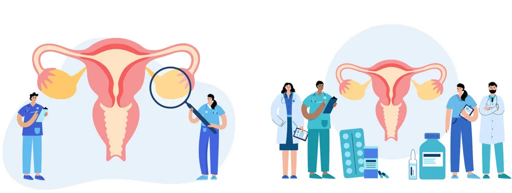 Hyaluron, chondroïtine en glucosamine voor de urinewegen