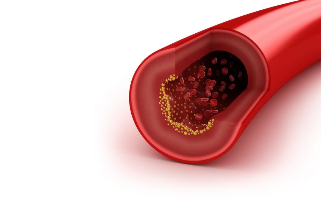 Cholesterol is niet ongezond
