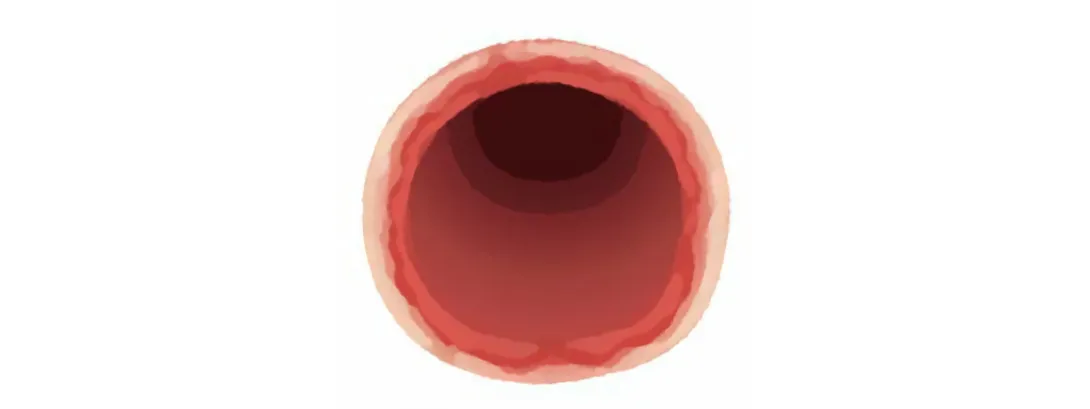 Vitamine C beschermt endotheel