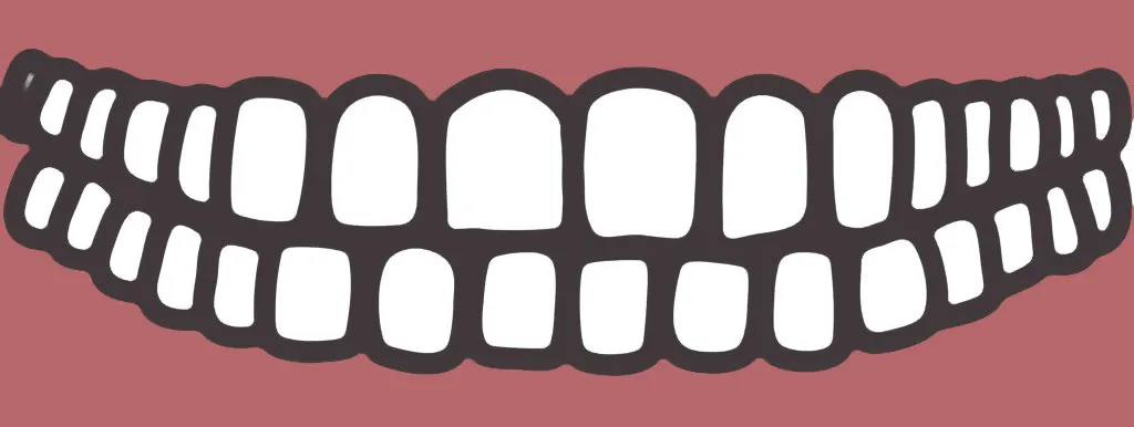 Arginine versus cariës