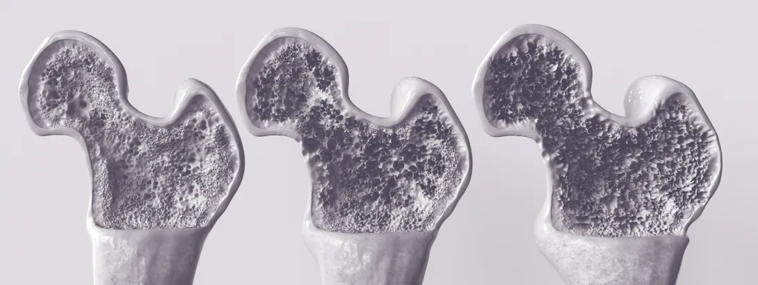 Calcium, meer dan alleen botgezondheid